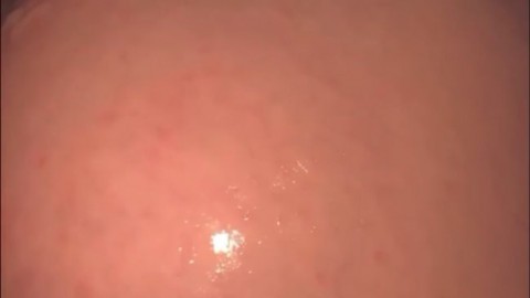 lAjuyYXpkcKGHkPnATvG