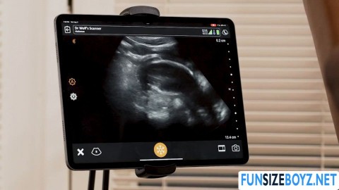 Damn! this doctor keeps fucking his black patient